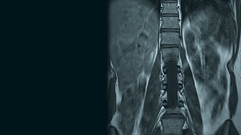 Anomalien und Normvarianten: Nierenagenesie