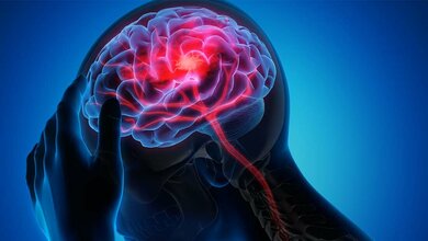 Jeder fünfte bis sechste körperliche Trigger für ein Broken-Heart-Syndrom ist eine akute Hirnerkrankungen