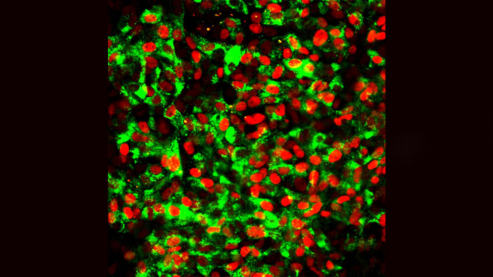 CD177_generierte_betazellaehnliche_Zellen_HZM.jpg CD177-generierte betazellähnliche Zellen
