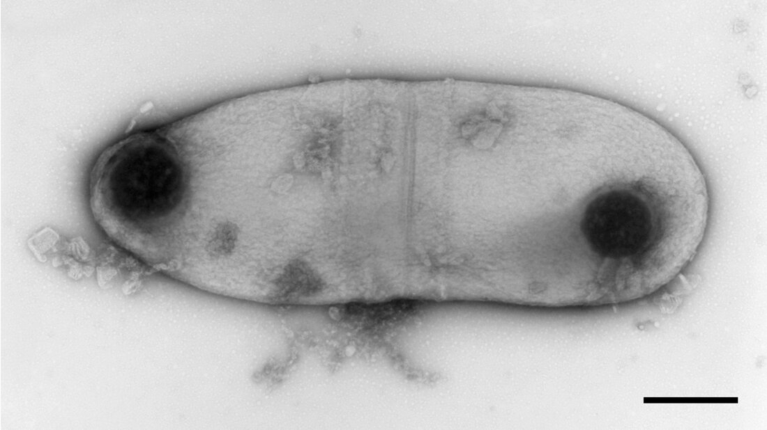 Abbildung von Corynebacterium diphtheriae mitis.
