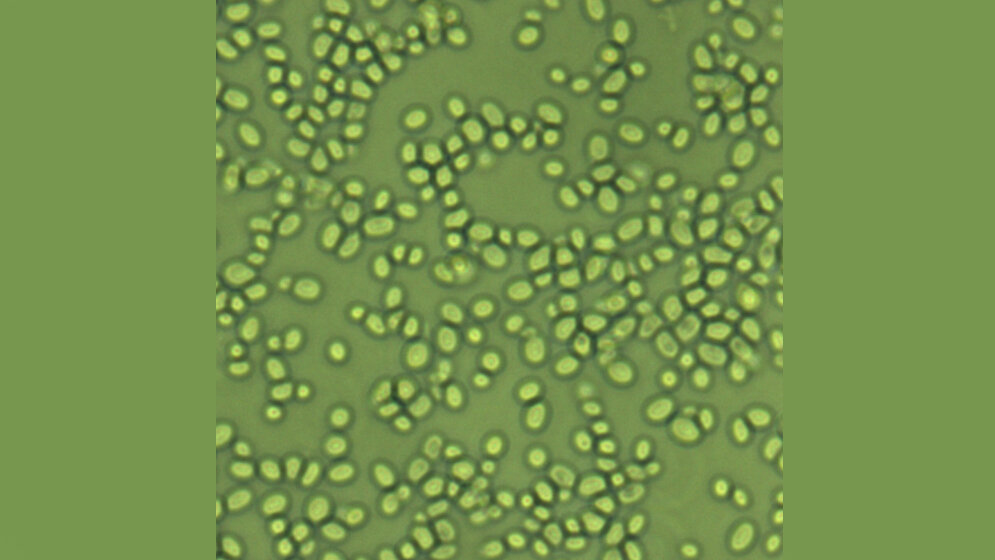 candida_glabrata.jpg Candida glabrata