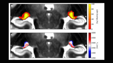 Hochaufloesende_MRT_Daten_CC_BY-NC.jpg Das obere Feld zeigt die Lage des visuell-sensorischen Thalamus in den hochauflösenden MRT-Daten