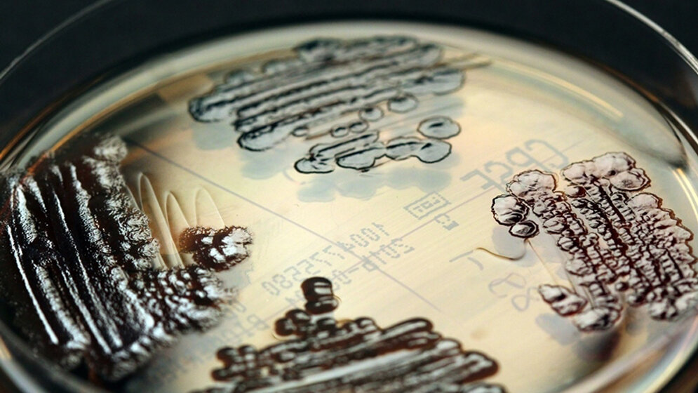 Multiresistente Enterobakterien