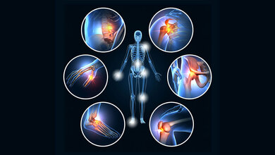Schaubild für Rheuma