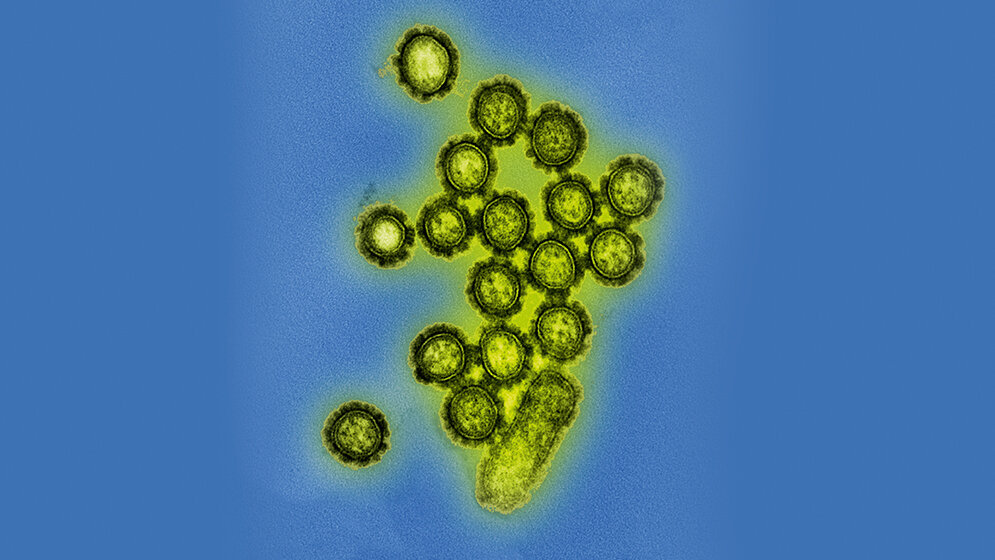 Vor 100 Jahren forderte die Spanische Grippe Millionen Tote (2)