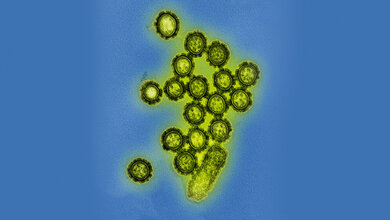 Vor 100 Jahren forderte die Spanische Grippe Millionen Tote (2)