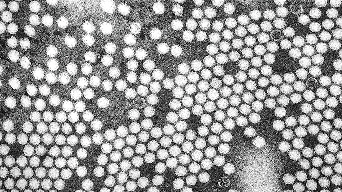 Titelbild zum Fachbeitrag über Ausbruch von Kinderlähmung im US-Bundesstaat New York