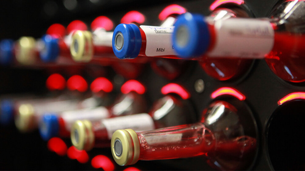 Blutvergiftung_Zeit_ist_entscheidender_Faktor_.jpg Sepsis