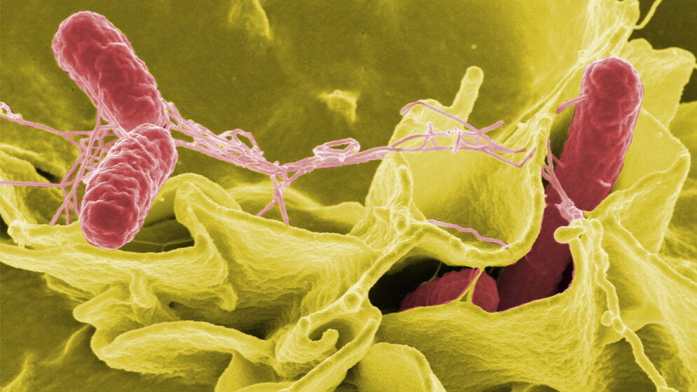 Salmonellen (rot eingefärbt)