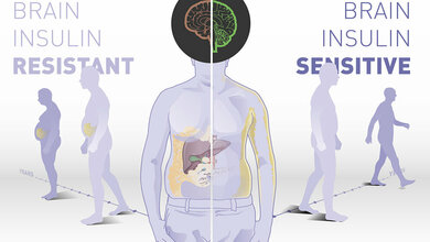 Insulinwirkung im Gehirn