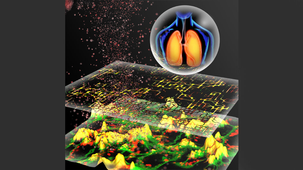 In_silico_Modellierung_von_Partikel_Zell_Interaktionen_HZM.jpg In-silico-Modellierung von Partikel-Zell-Interaktionen