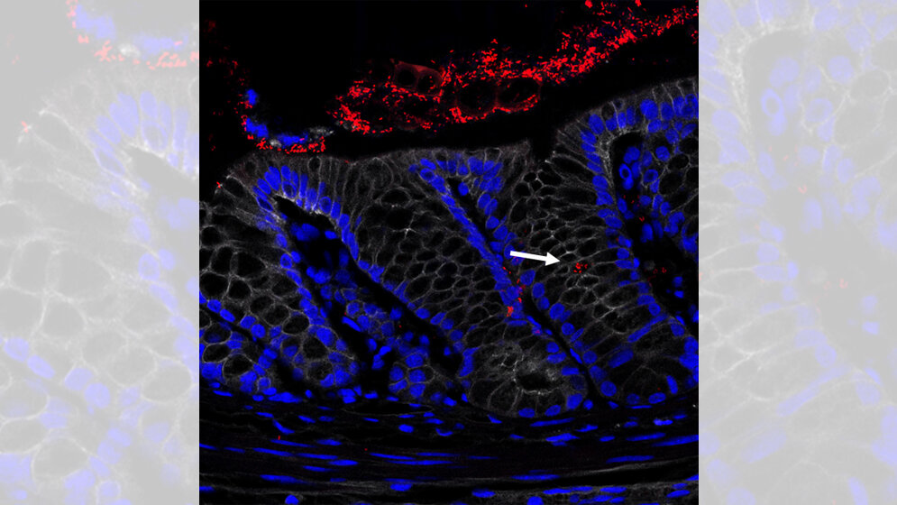 Querschnitt eines entzündeten Dickdarms