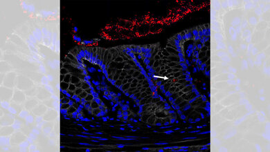 Querschnitt eines entzündeten Dickdarms
