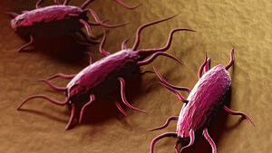 Titelbild des Fachbeitrags über Listeriose