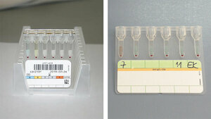 Das Säulenagglutinationsverfahren zur Blutgruppenbestimmung