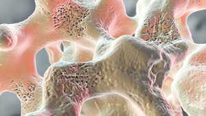 Titelbild zum englischen Fachbeitrag über „Osteoporosis“