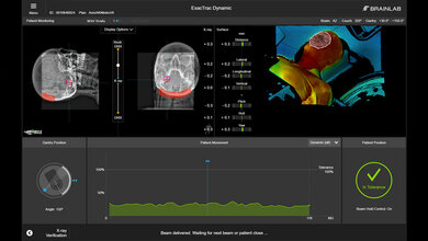 ExacTrac Dynamic Patient Montoring