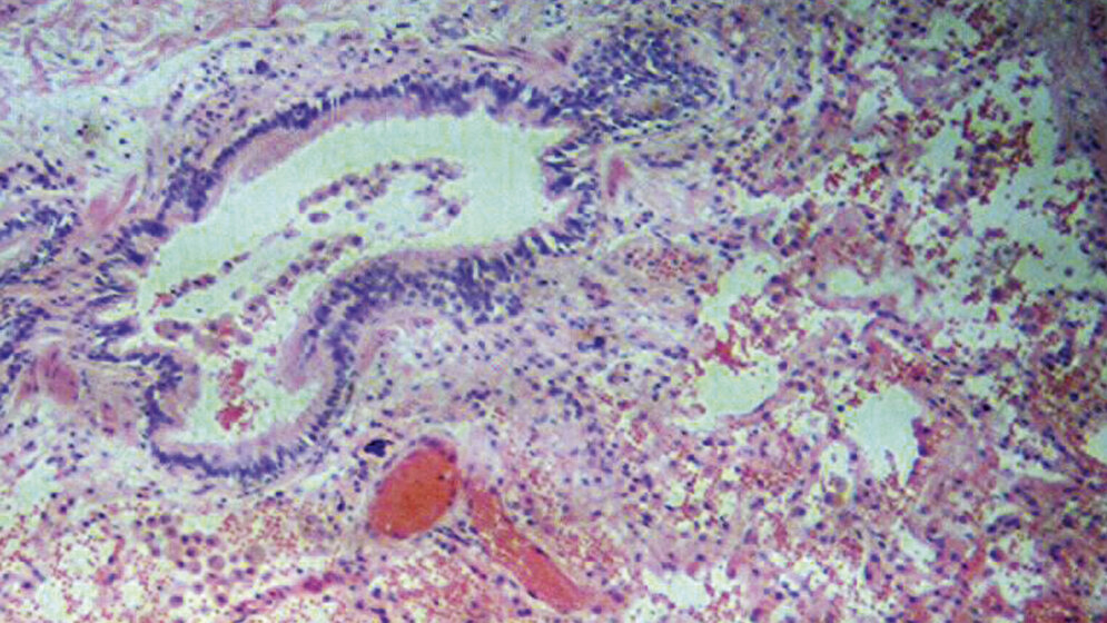 Immunhistochemie der Lunge