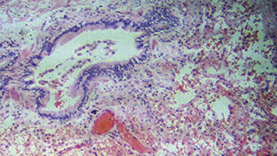 Immunhistochemie der Lunge