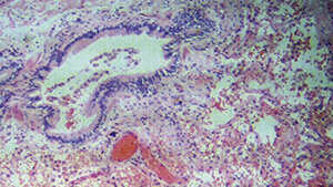 Immunhistochemie der Lunge