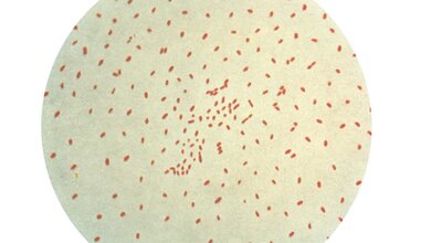 Bordetella pertussis