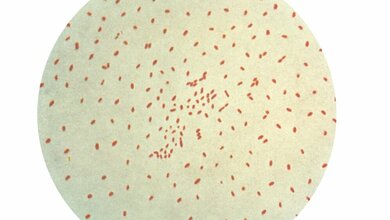 Bordetella pertussis
