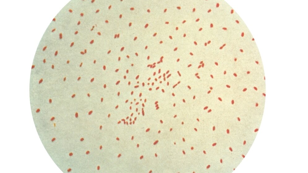 Bordetella pertussis