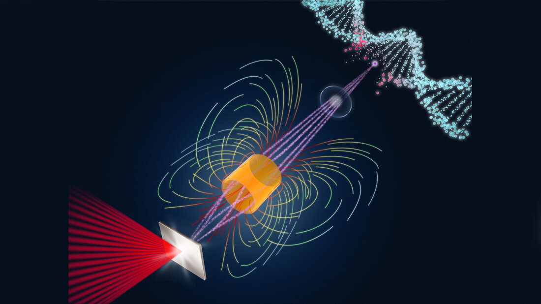 Protonen.jpg Bestrahlung von Tumoren mit Laser-Protonen