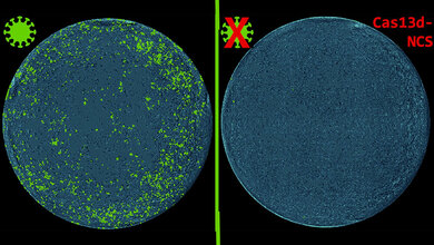 Cas13d-NCS-Behandlung SARS-CoV-2