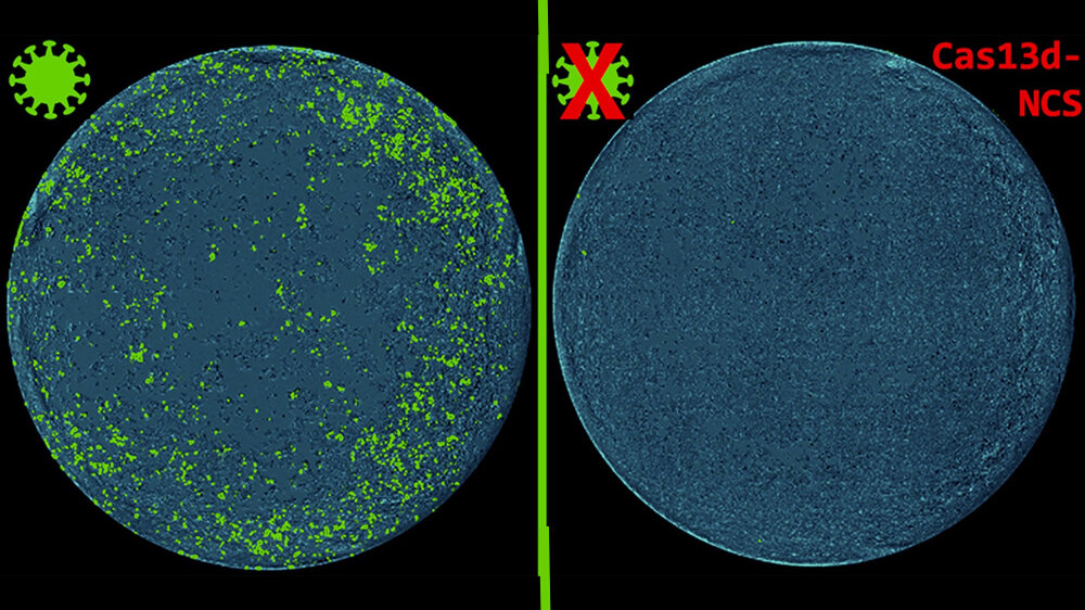 Cas13d-NCS-Behandlung SARS-CoV-2