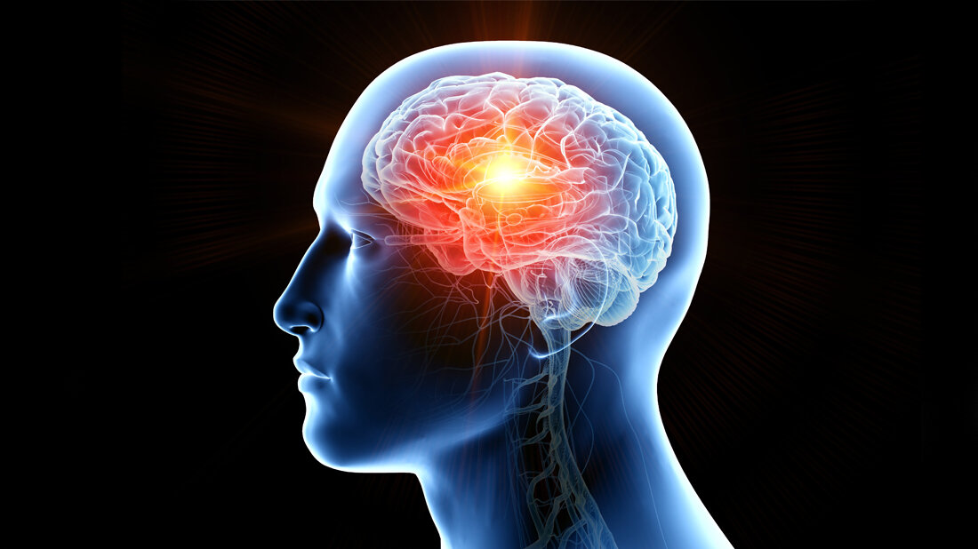 Stereotaktischer Radiochirurgie bei Hirnmetastasen