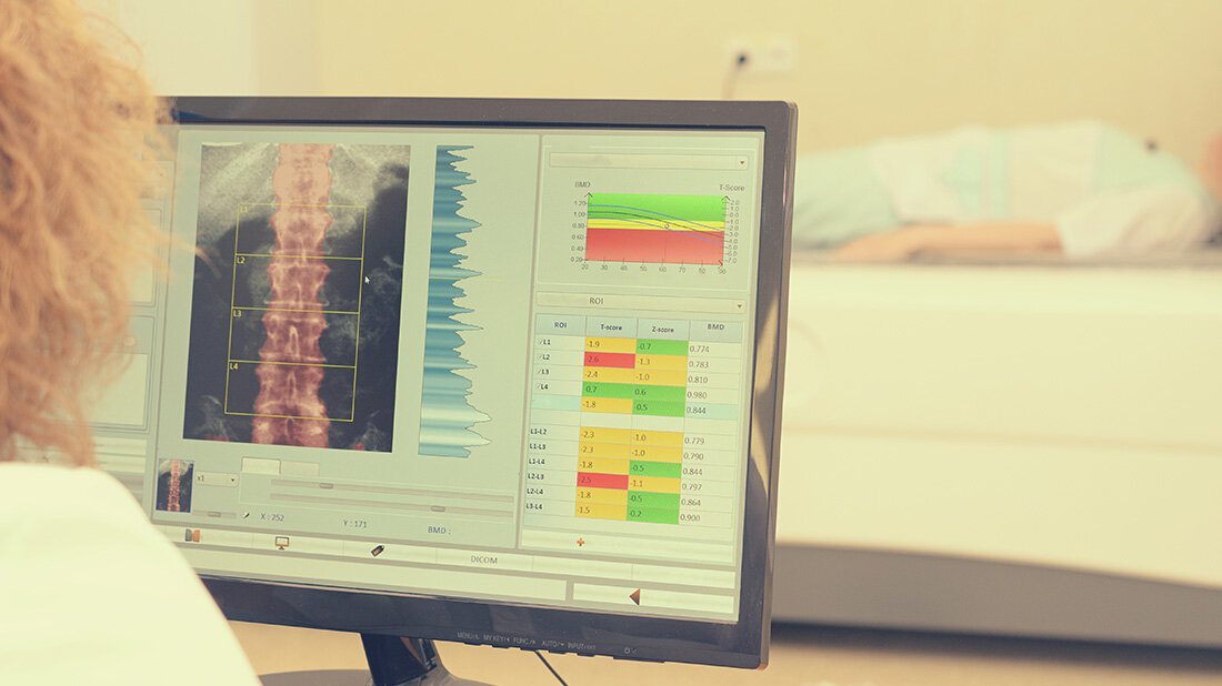 Knochendichte.jpg Bildschirm zeigt eine medizinische Analyse der Wirbelsäule, im Hintergrund liegt eine Patientin auf einer Untersuchungsliege.