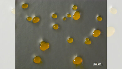 Myxococcus xanthus-Zellen