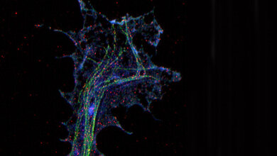 Hochauflösende Mikroskopie einer Axonterminale