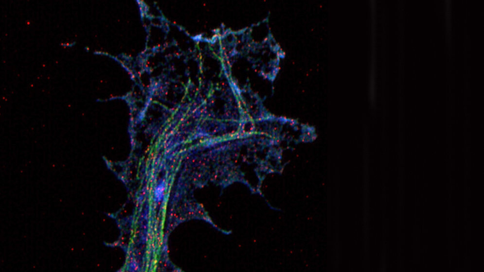 Hochauflösende Mikroskopie einer Axonterminale