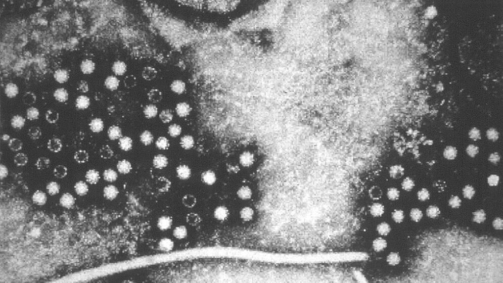 Hepatitis E-Virus