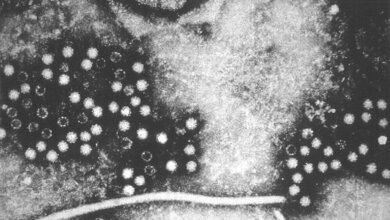Hepatitis E-Virus