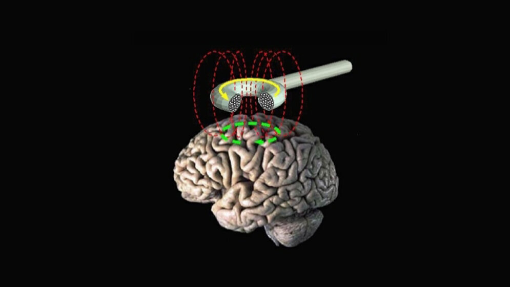 Schematische Darstellung der transkraniellen Magnetstimulation