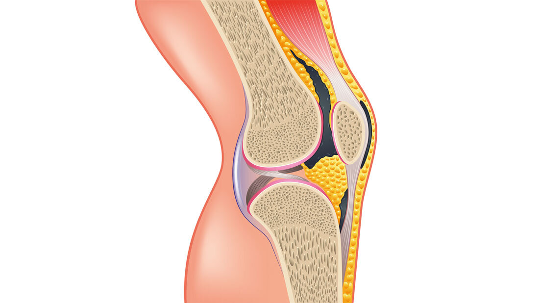 Aufbau des Knies.