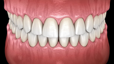 Grafik mit Frontalansicht des menschlichen Gebisses