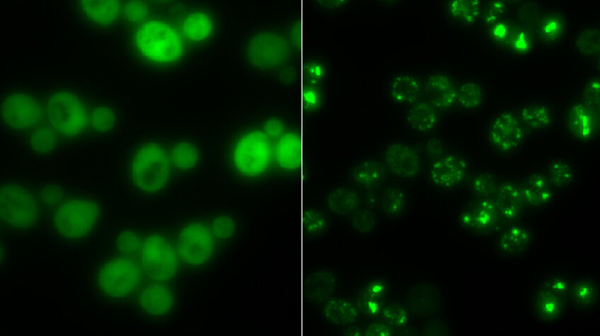 Bei Stress verklumpen Proteine bild2csm_Hefezellen_Gruppe_Prof_Matthias_Peter_ETH_Zürich_1b9022a8db.jpg