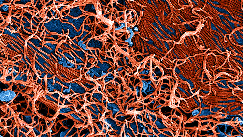 Ebola-Virus – Erreger des hämorrhagischen Fiebers Mikrobiologie