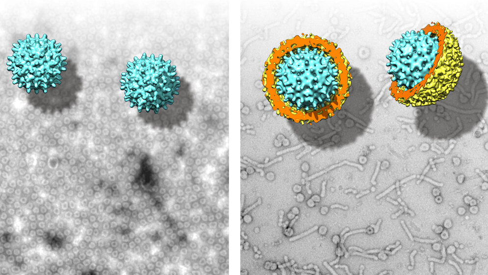 Hepatitis B