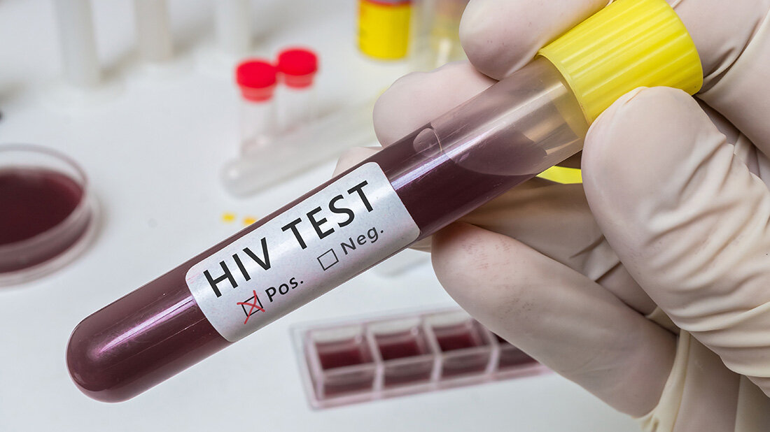 HIV_in_Deutschland.jpg Zi-Studie zur regionalen Verteilung von HIV