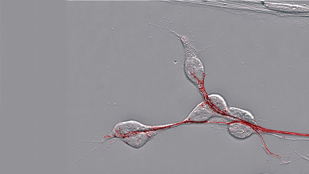 Pionierneuronen
