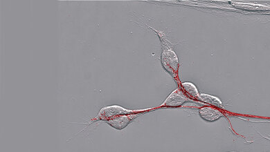 Pionierneuronen_unter_Phasenkontrastmikroskop_TiHo_17082016.jpg Pionierneuronen