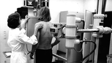 Wolfsburg, Volkswagen, Röntgenuntersuchung