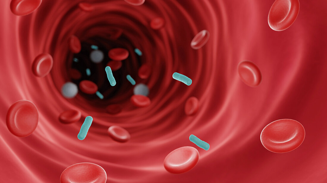 Titelbild zum Fachbeitrag über die Vermeidung von Kontaminationen bei der Abnahme von Blutkulturen