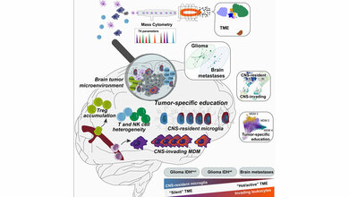 Das Mikromilieu eines Hirntumors 
