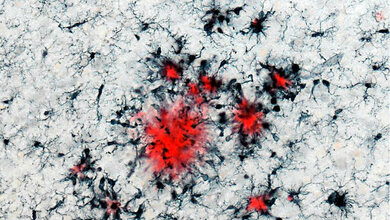 Immunzellen und Plaques